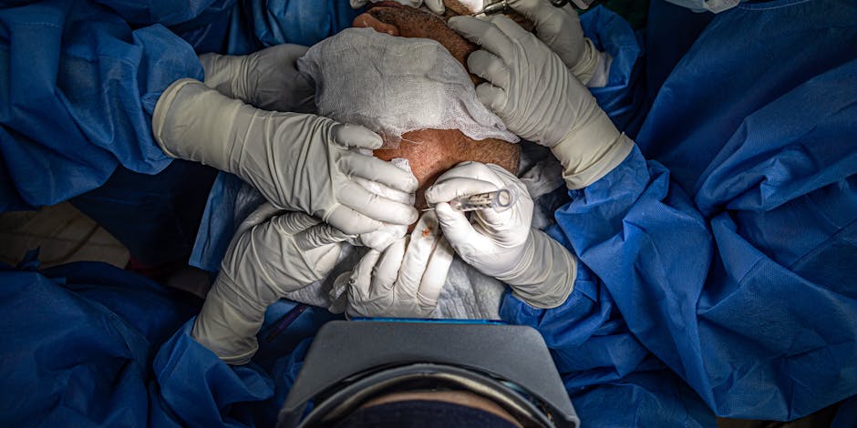 The Comprehensive Guide to Hair Transplant: Everything You Need to Know
